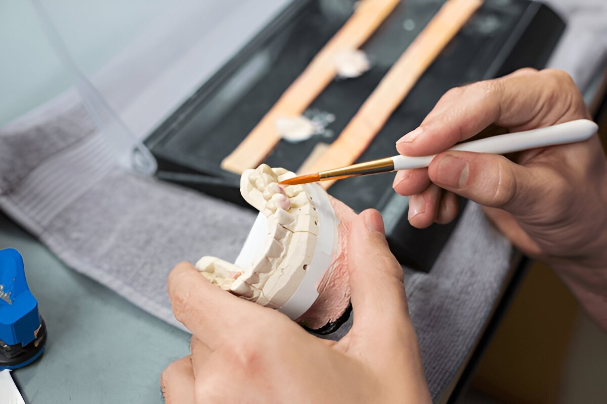 dental inlays and onlays in wilmington, de