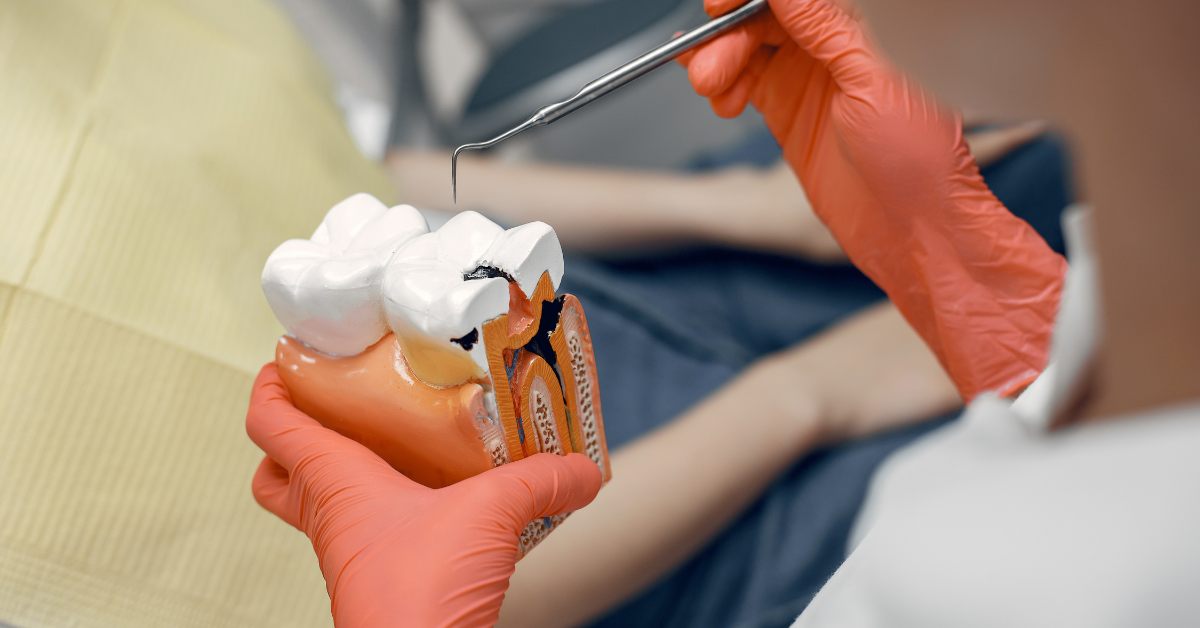 root canal recovery what to expect after treatment