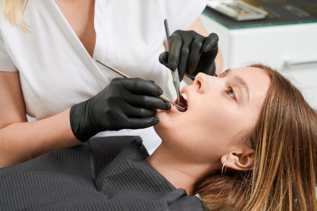 what are composite fillings and how do they work